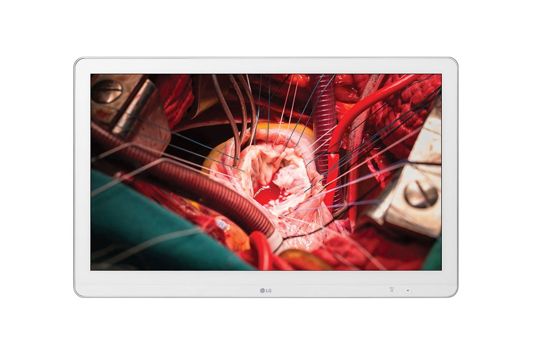 LG 27 (68.58cm) Full HD Surgical Monitor